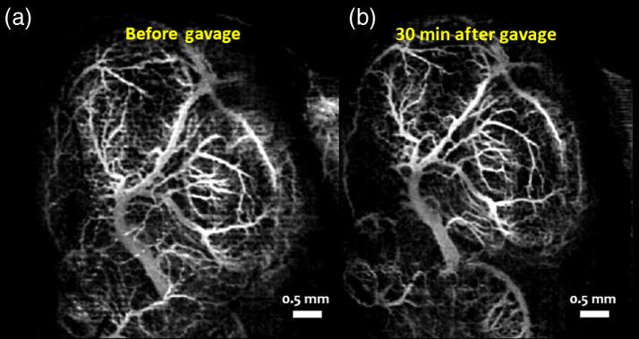 https://cdn.ncbi.nlm.nih.gov/pmc/blobs/772b/7689263/8cf245daadb2/JBO-025-126001-g009.jpg