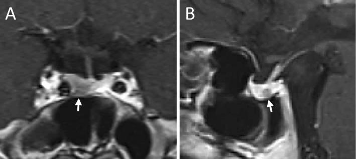 https://cdn.ncbi.nlm.nih.gov/pmc/blobs/772d/5140872/8dd960693f41/1349-7235-55-3185-g002.jpg