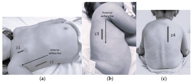 https://cdn.ncbi.nlm.nih.gov/pmc/blobs/773a/11352824/f34dd1ec5e5c/children-11-00987-g001.jpg