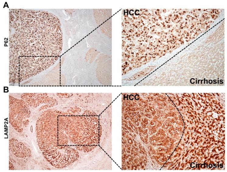 https://cdn.ncbi.nlm.nih.gov/pmc/blobs/773c/6912708/ee2d8d1e2f46/cells-08-01308-g006.jpg