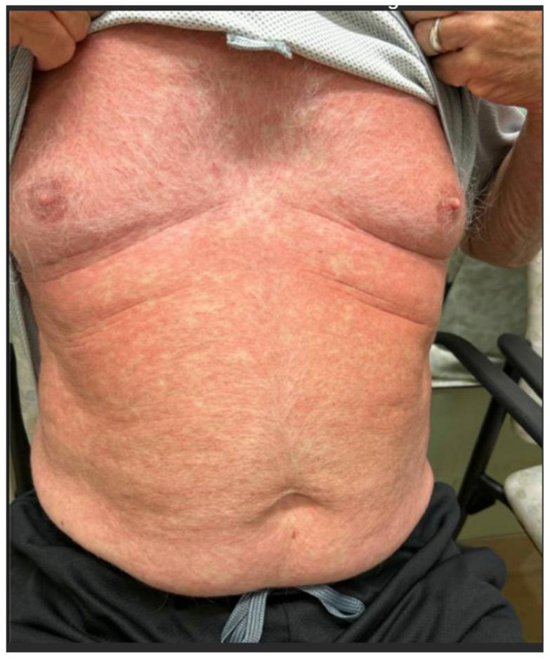 https://cdn.ncbi.nlm.nih.gov/pmc/blobs/7741/11763385/c880713b35e9/cancers-17-00251-g001.jpg