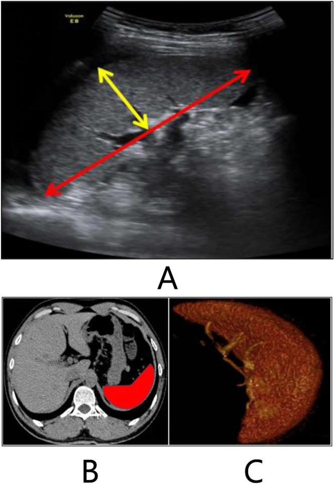 https://cdn.ncbi.nlm.nih.gov/pmc/blobs/7745/10439804/3caf0048dd45/RMHP-16-1555-g0001.jpg