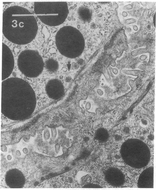 https://cdn.ncbi.nlm.nih.gov/pmc/blobs/7746/296915/e4ce28a18d67/jcinvest00077-0279-c.jpg