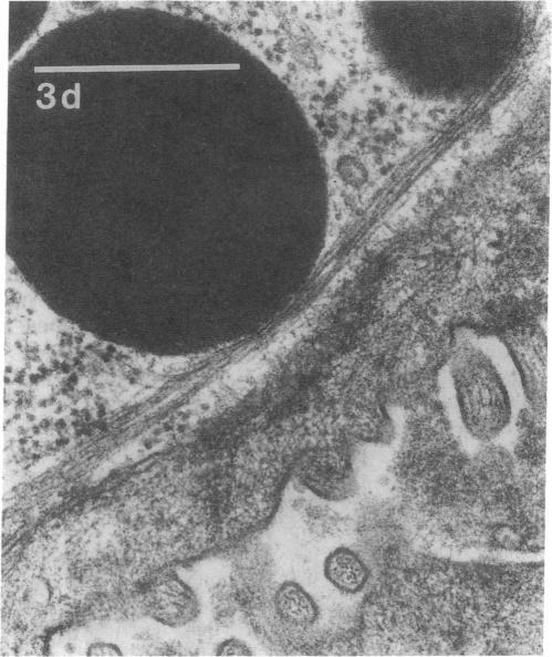 https://cdn.ncbi.nlm.nih.gov/pmc/blobs/7746/296915/e8e07ba791f0/jcinvest00077-0279-d.jpg