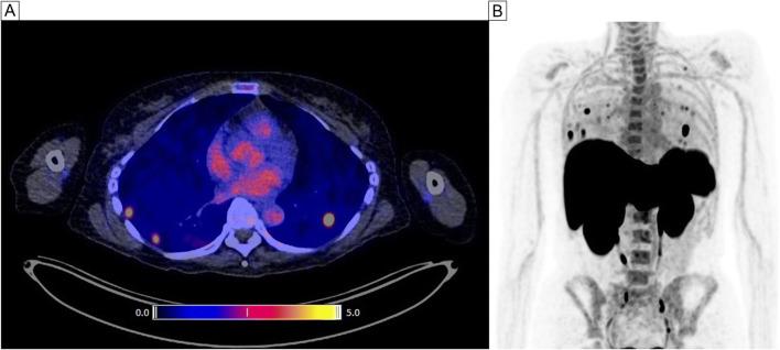 https://cdn.ncbi.nlm.nih.gov/pmc/blobs/774c/8566634/470275222b8e/259_2021_5407_Fig2_HTML.jpg