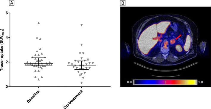 https://cdn.ncbi.nlm.nih.gov/pmc/blobs/774c/8566634/549d6fb7b627/259_2021_5407_Fig3_HTML.jpg