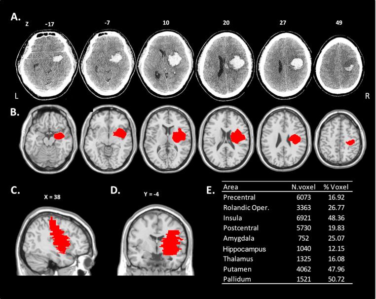 https://cdn.ncbi.nlm.nih.gov/pmc/blobs/7751/6078710/b2b58606b628/gr4.jpg