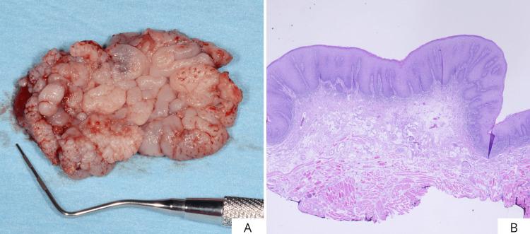 https://cdn.ncbi.nlm.nih.gov/pmc/blobs/7757/12395392/26bb11aa07b8/cureus-0017-00000089045-i05.jpg