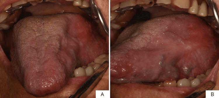 https://cdn.ncbi.nlm.nih.gov/pmc/blobs/7757/12395392/3461c3687ba9/cureus-0017-00000089045-i11.jpg