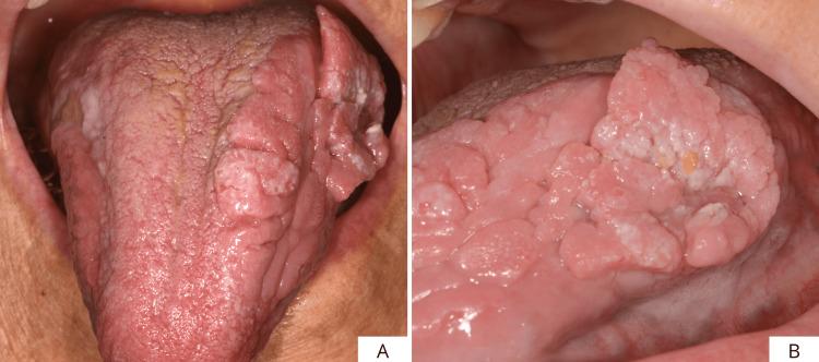 https://cdn.ncbi.nlm.nih.gov/pmc/blobs/7757/12395392/51ea5276cd1d/cureus-0017-00000089045-i01.jpg