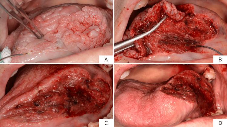 https://cdn.ncbi.nlm.nih.gov/pmc/blobs/7757/12395392/7052627abedb/cureus-0017-00000089045-i03.jpg