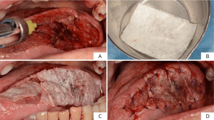 https://cdn.ncbi.nlm.nih.gov/pmc/blobs/7757/12395392/e71f7529d438/cureus-0017-00000089045-i04.jpg