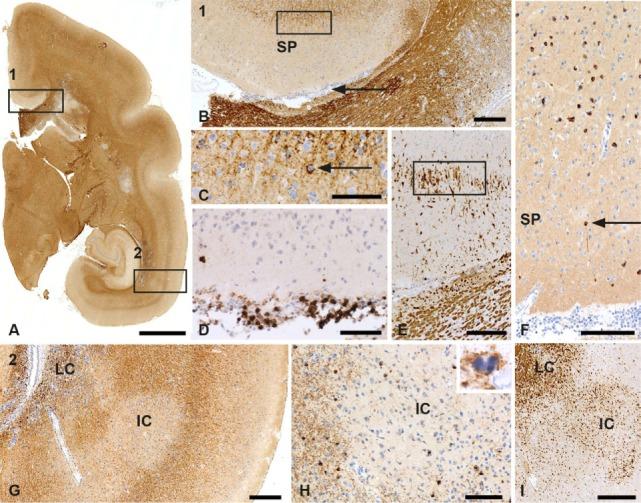 https://cdn.ncbi.nlm.nih.gov/pmc/blobs/7757/5504154/b3abca6e3192/fimmu-08-00804-g003.jpg