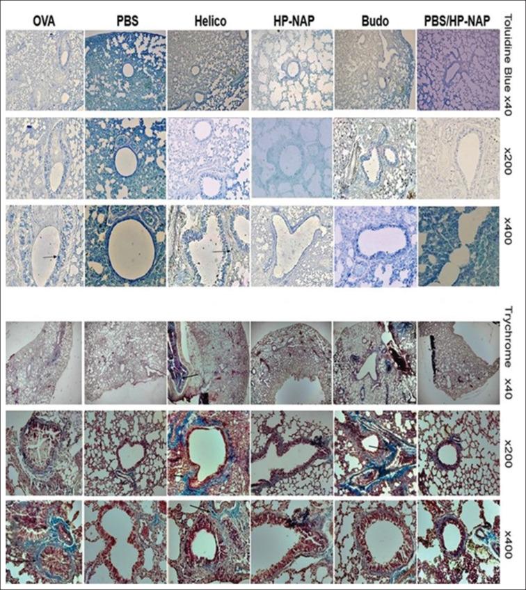 https://cdn.ncbi.nlm.nih.gov/pmc/blobs/775e/12039875/6be5b708a7ff/ABR-14-28-g002.jpg