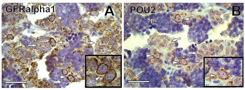 https://cdn.ncbi.nlm.nih.gov/pmc/blobs/775e/7226347/61304db248fb/biomolecules-10-00644-g005.jpg