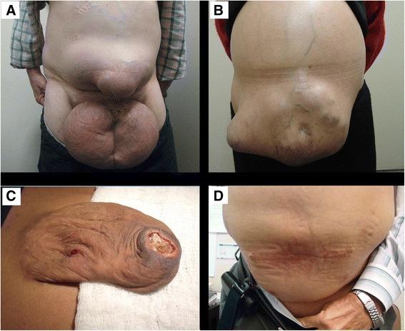 https://cdn.ncbi.nlm.nih.gov/pmc/blobs/7761/4443633/2e93dd535e57/12893_2015_52_Fig1_HTML.jpg