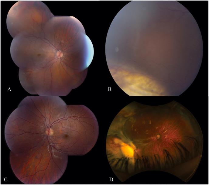 https://cdn.ncbi.nlm.nih.gov/pmc/blobs/7772/10876588/d241cda4587b/gr2.jpg