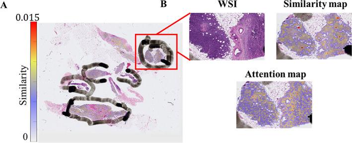 https://cdn.ncbi.nlm.nih.gov/pmc/blobs/7776/10766034/0efe44781812/CJP2-10-e344-g002.jpg