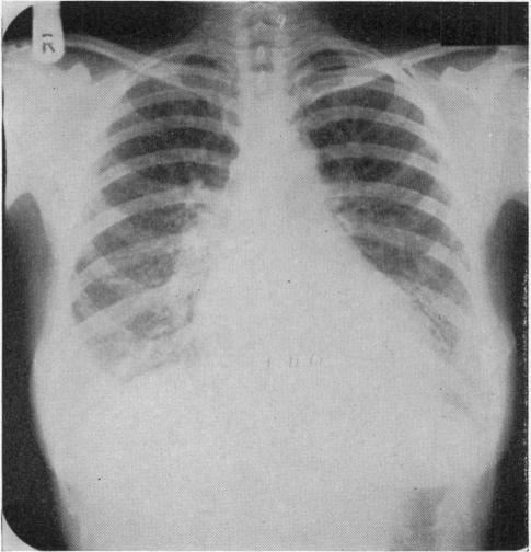 https://cdn.ncbi.nlm.nih.gov/pmc/blobs/7776/1872295/07499f8286c4/brmedj02507-0063-d.jpg
