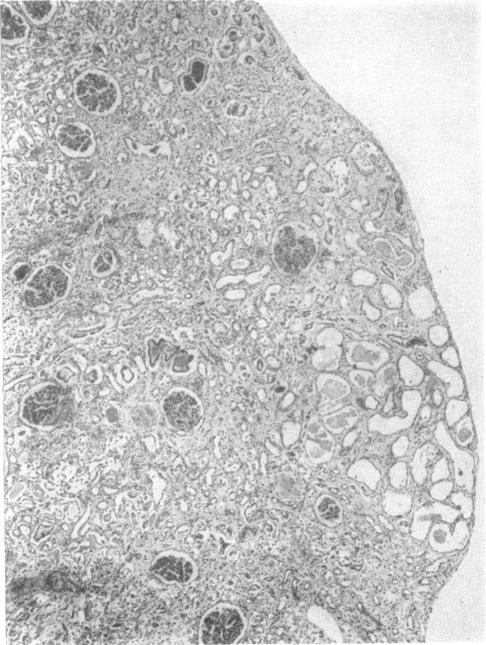 https://cdn.ncbi.nlm.nih.gov/pmc/blobs/7776/1872295/b5beed8acdb4/brmedj02507-0064-b.jpg
