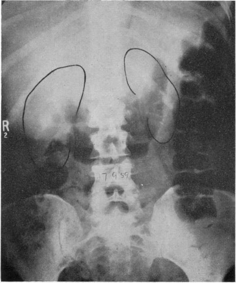 https://cdn.ncbi.nlm.nih.gov/pmc/blobs/7776/1872295/dd9c80bb4588/brmedj02507-0063-b.jpg