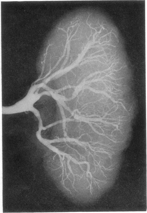 https://cdn.ncbi.nlm.nih.gov/pmc/blobs/7776/1872295/f016a1ef03a1/brmedj02507-0064-c.jpg
