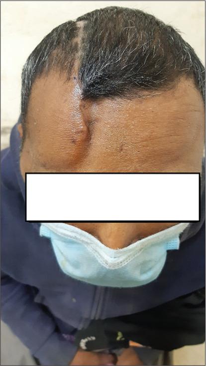https://cdn.ncbi.nlm.nih.gov/pmc/blobs/7776/9282781/677e3fb2f707/SNI-13-270-g005.jpg