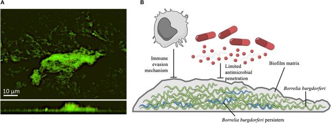 https://cdn.ncbi.nlm.nih.gov/pmc/blobs/777c/6287027/bfe57852f860/fneur-09-01048-g0001.jpg