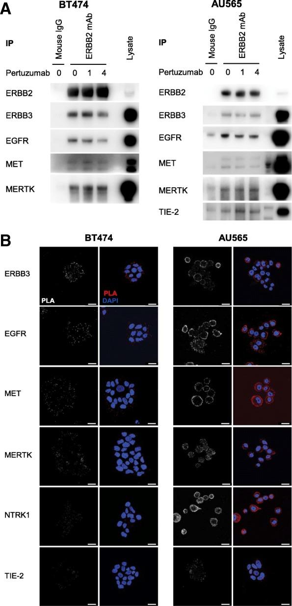 https://cdn.ncbi.nlm.nih.gov/pmc/blobs/7789/6429830/e7085387c9d9/13058_2019_1127_Fig4_HTML.jpg
