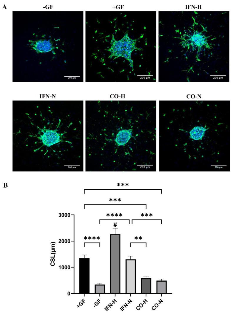 https://cdn.ncbi.nlm.nih.gov/pmc/blobs/778b/8946902/9fb7b4176c5c/cells-11-00988-g008.jpg
