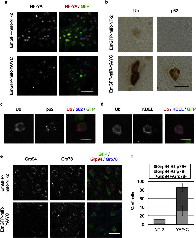https://cdn.ncbi.nlm.nih.gov/pmc/blobs/778c/5043352/4a7b0b7c4694/srep34575-f5.jpg
