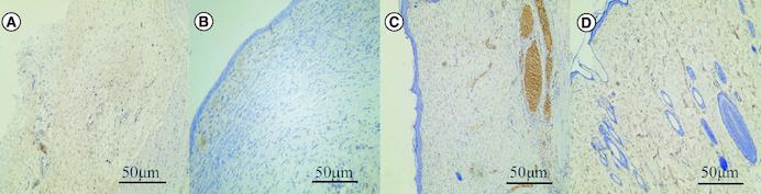 https://cdn.ncbi.nlm.nih.gov/pmc/blobs/778e/11137796/47aa37ca7dd7/IFSO_A_2341547_F0006_C.jpg