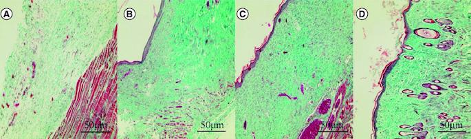 https://cdn.ncbi.nlm.nih.gov/pmc/blobs/778e/11137796/b69793371ae2/IFSO_A_2341547_F0007_C.jpg