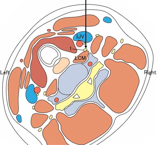 https://cdn.ncbi.nlm.nih.gov/pmc/blobs/7794/9550383/748a625c549a/2432-0935-5-1-0014-g003.jpg