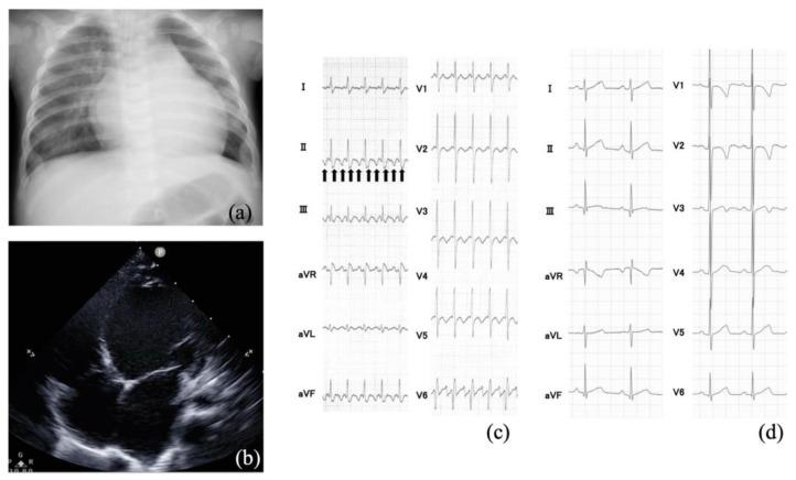 https://cdn.ncbi.nlm.nih.gov/pmc/blobs/7795/11172730/a62ce24a0a1f/jcm-13-03313-g002.jpg