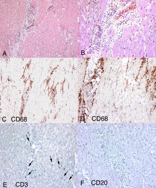 https://cdn.ncbi.nlm.nih.gov/pmc/blobs/7796/2396599/fe0f7a2490f5/1746-1596-3-21-1.jpg