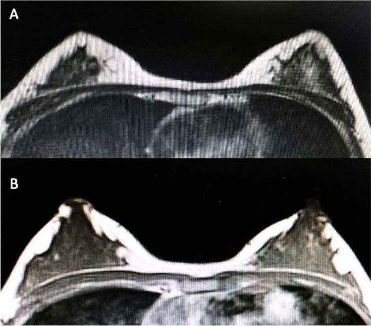 https://cdn.ncbi.nlm.nih.gov/pmc/blobs/7797/11233364/178907806df6/266_2024_3870_Fig6_HTML.jpg