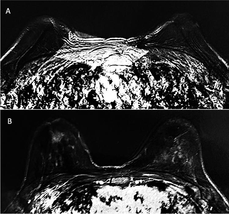 https://cdn.ncbi.nlm.nih.gov/pmc/blobs/7797/11233364/e118744eb355/266_2024_3870_Fig5_HTML.jpg