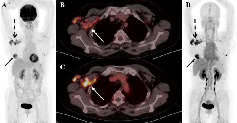 https://cdn.ncbi.nlm.nih.gov/pmc/blobs/779b/10949888/1538b19bde10/fonc-14-1358070-g003.jpg