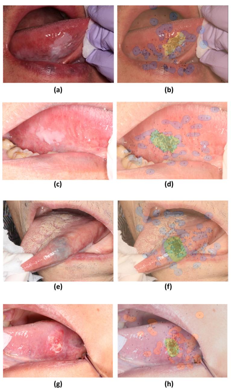 https://cdn.ncbi.nlm.nih.gov/pmc/blobs/77a3/10780288/0daa754162b3/jcm-13-00136-g005.jpg
