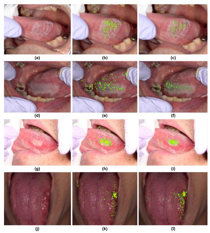 https://cdn.ncbi.nlm.nih.gov/pmc/blobs/77a3/10780288/408ccbfbc4e8/jcm-13-00136-g004.jpg