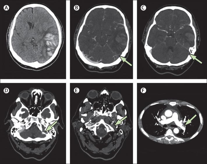 https://cdn.ncbi.nlm.nih.gov/pmc/blobs/77ab/8346241/ad7f4d0721f8/gr1_lrg.jpg