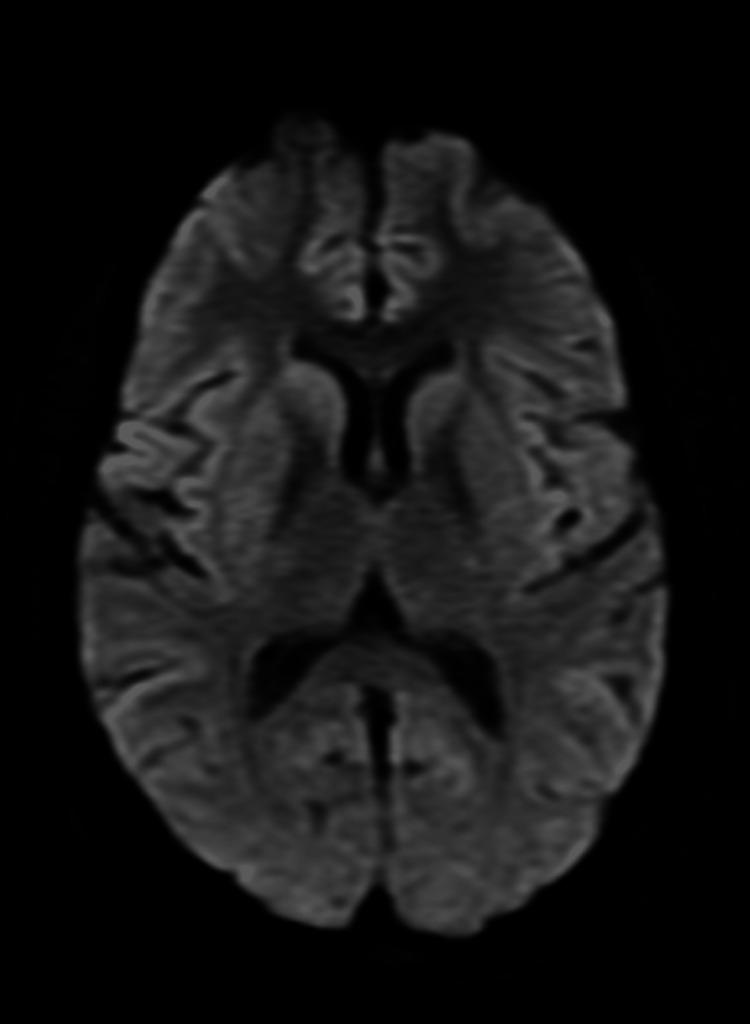 https://cdn.ncbi.nlm.nih.gov/pmc/blobs/77b3/11348870/1d179d9d29a5/cureus-0016-00000065290-i03.jpg