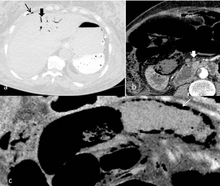 https://cdn.ncbi.nlm.nih.gov/pmc/blobs/77b7/5198631/4f9358dba55b/gr1.jpg