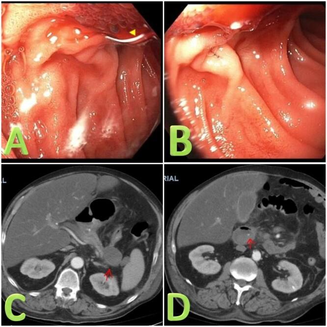 https://cdn.ncbi.nlm.nih.gov/pmc/blobs/77b8/9239023/e21f112fd689/3337_Fig1.jpg
