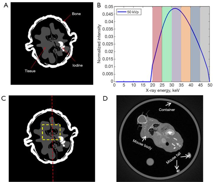 https://cdn.ncbi.nlm.nih.gov/pmc/blobs/77bc/11744124/28309cf515a4/qims-15-01-581-f2.jpg