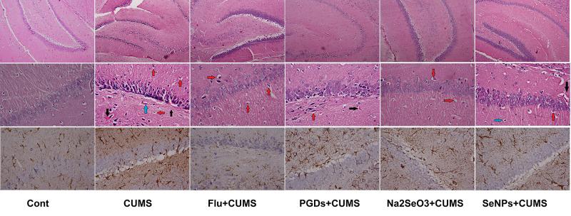https://cdn.ncbi.nlm.nih.gov/pmc/blobs/77bf/8722537/d29854f3f1f0/IJN-16-8447-g0009.jpg