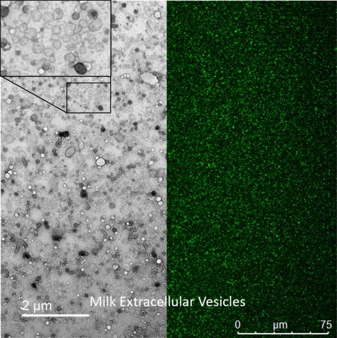 https://cdn.ncbi.nlm.nih.gov/pmc/blobs/77c0/12079498/2beb453c0948/BTM2-10-e10756-g002.jpg