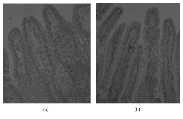 https://cdn.ncbi.nlm.nih.gov/pmc/blobs/77cb/5516756/886623260917/DM2017-5238134.001.jpg
