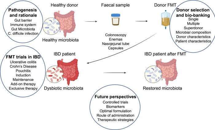 https://cdn.ncbi.nlm.nih.gov/pmc/blobs/77cd/10423477/aa2665c2f43b/gutjnl-2023-329948f01.jpg